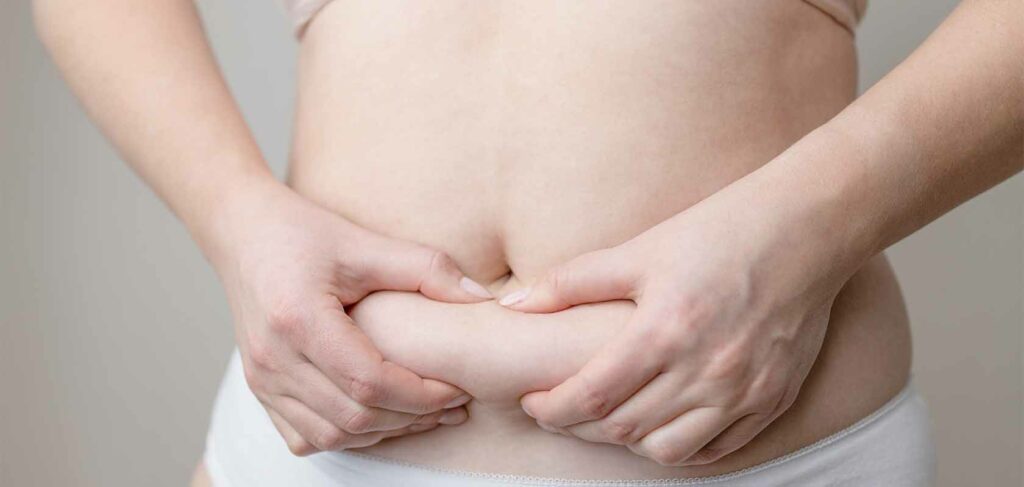 Karın Germe (Liposuction) Yöntemleri Nelerdir?